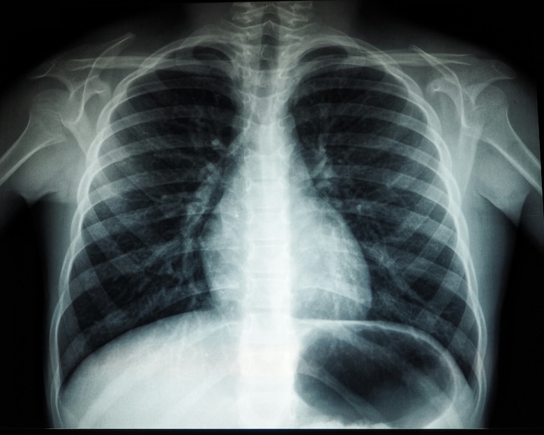 Medical Imaging
